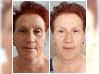 Услуги - Красота и здоровье - Массаж лица