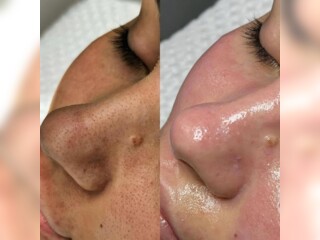 Услуги - Красота и здоровье - Косметолог