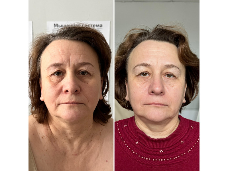 Услуги - Красота и здоровье - Массаж лица