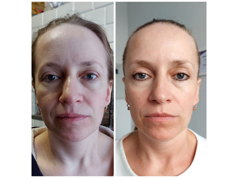 Услуги - Красота и здоровье - Массаж лица