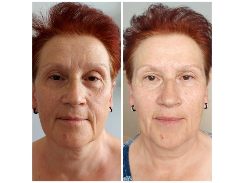 Услуги - Красота и здоровье - Массаж лица