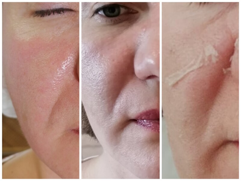 Услуги - Красота и здоровье - Косметолог