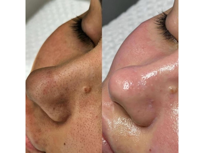 Услуги - Красота и здоровье - Косметолог